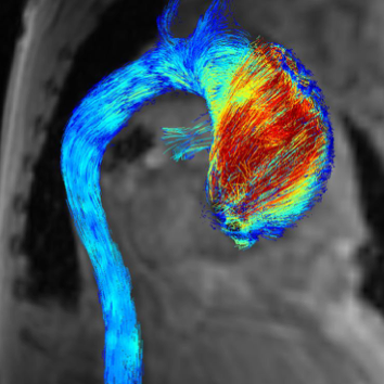 Enlarged view: Cardiovascular Magnetic Resonance